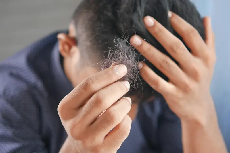A man checking his hairline with his fingers